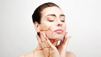 Tips Merawat juga Mengatasi Kulit Kering