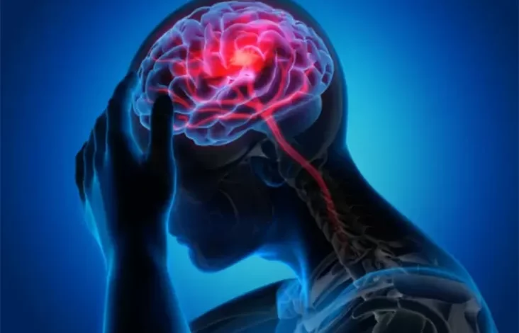 Gejala, Penyebab, kemudian Pencegahan Stroke Iskemik, Penyakit yang digunakan mana Sebabkan Kematian Park Jin Ah