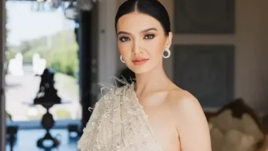 Raline Shah Pernah Idap Bell’s Palsy, Tak Bisa Tersenyum hingga Pasrah
