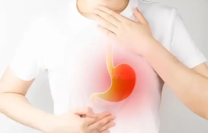 5 Penyelesaian Asam Lambung Alami, Pisang Bisa Jadi Antasida