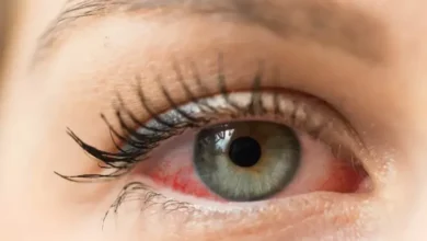 Mata Bisa Deteksi Dini Diabetes hingga Kanker, Perhatikan Tanda-tandanya