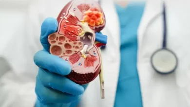 8 Tanda Ginjal Bermasalah, Perubahan Warna Urine Sering Diabaikan