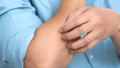 Ciri Gatal Hal ini Tanda Awal Diabetes yang mana digunakan Jarang Diketahui, Jangan Asal Garuk