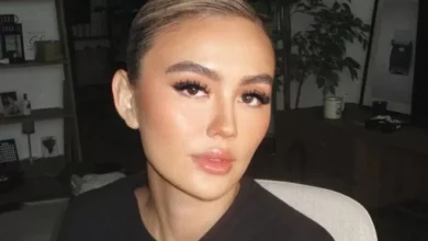 Mengenal Alopecia Areata, Penyakit yang digunakan digunakan Menjangkit Agnez Mo hingga Alami Kebotakan
